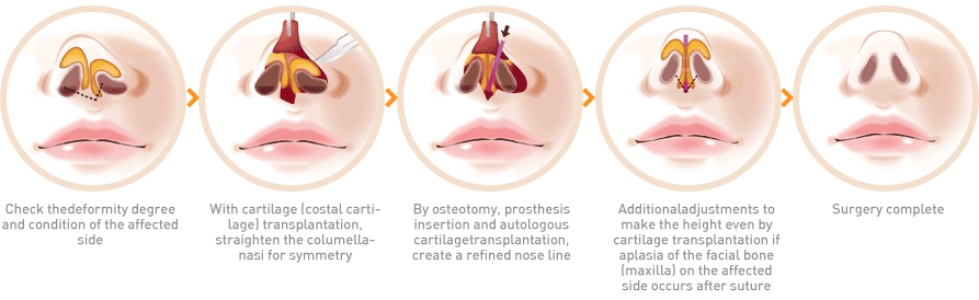 Procedure for surgery 